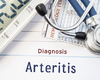 L’artérite à cellules géantes subclinique augmente le risque de rechute dans la polymyalgie rhumatismale