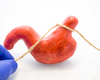 Rem op bariatrische chirurgie van kracht