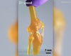 Une articulation du genou fonctionnelle imprimée en 3D 