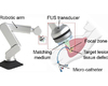 Een nieuwe methode maakt 3D-printen rechtstreeks in het menselijk lichaam mogelijk