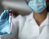 Ebola : L'institut de médecine tropicale d'Anvers étudie la réponse immunitaire au nouveau variant