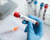 Doorbraak in hiv-onderzoek: methode ontwikkeld die virus definitief onschadelijk maakt 