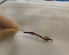 Thrombectomie : cap des 180 procédures franchi en 2025 en région liégeoise