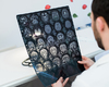 Un nouveau test permet de déterminer la meilleure façon de traiter une tumeur cérébrale