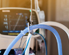 L’impact du moment de l’intubation chez le patient Covid-19 au cours des quatre vagues de la pandémie