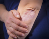 L’efficacité du deucravacitinib à un an dans le rhumatisme psoriasique
