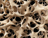Artrose en osteoporose: bloemlezing uit de literatuur van de afgelopen 12 maanden