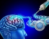 Remplacer les neurones morts dans un AVC: du rêve à la réalité?