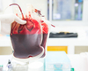 Het epos van de transfusie van gecitrateerd bloed