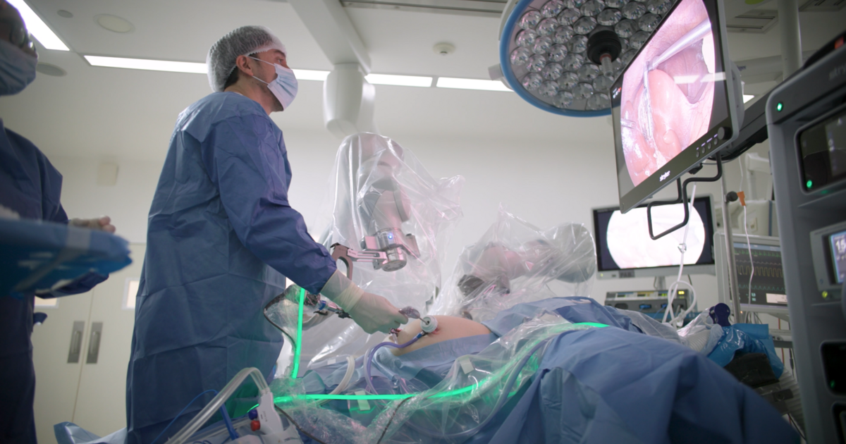 Een camera geleid door artificiële intelligentie maakt solo-chirurgie ...