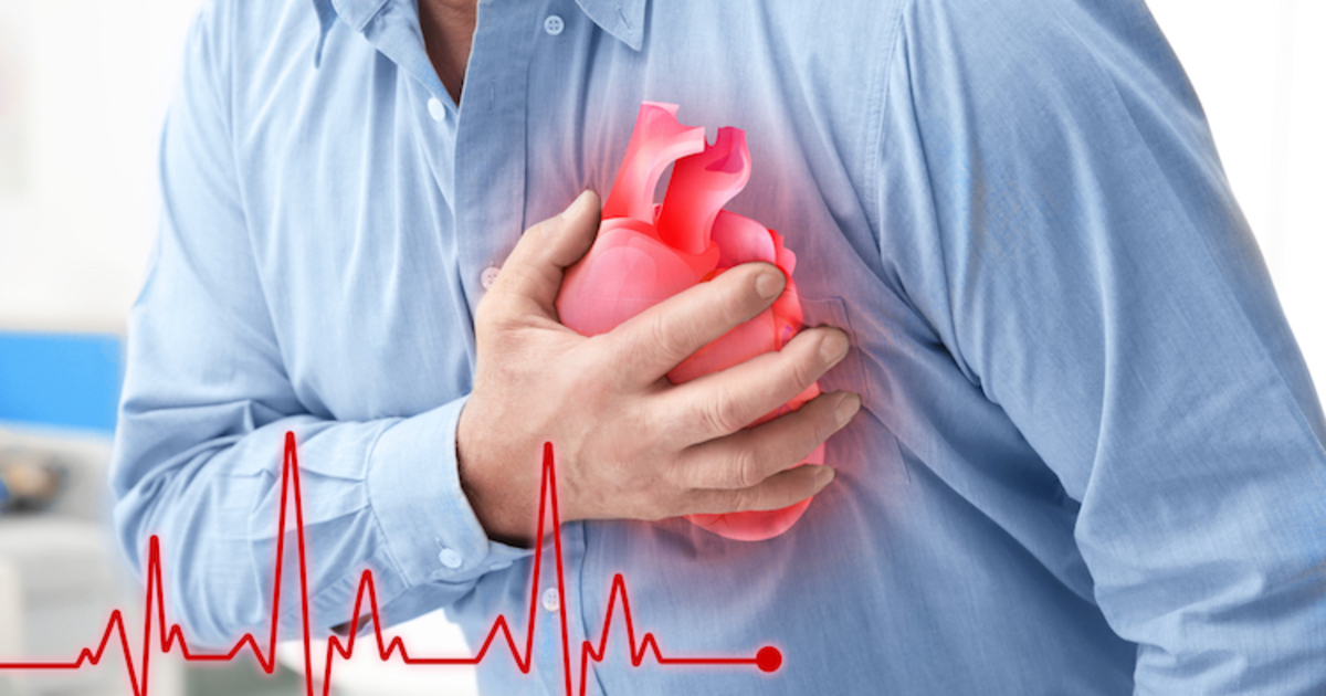 Les maladies cardiovasculaires tuent 10.000 personnes par jour en ...