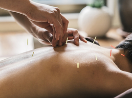 L'acupuncture efficace contre quoi? L'intrigant exemple de l'angine de poitrine