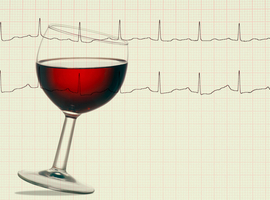 Alcool et FA: la fréquence est plus importante que la quantité