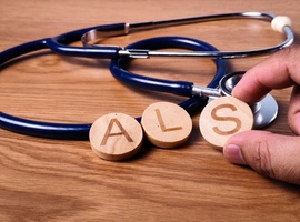 Une élévation du taux sérique de SIRT2 est associée à une progression rapide et à des troubles cognitifs dans la SLA