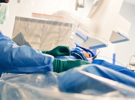 Myopathie auriculaire: le chaînon manquant entre la fibrillation auriculaire et l’insuffisance cardiaque