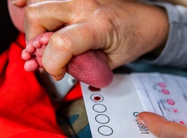 Dépistage néonatal génomique: vers une identification précoce et ciblée des maladies rares