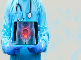Quand l’immunothérapieet les biomarqueurs redéfinissent la prise en charge péri-opératoire