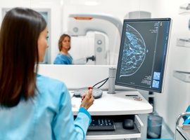Cancer du sein: l'Institut Jules Bordet publie des résultats prometteurs