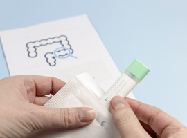 Comment favoriser la participation au dépistage du cancer colorectal par test immunochimique fécal?