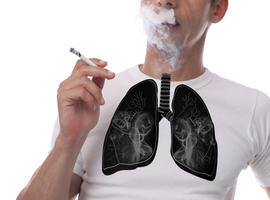 Le tabagisme à l'origine de huit cas de cancer du poumon sur dix