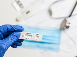 Drie Waalse biotechbedrijven ontwikkelen serologische test: wereldprimeur?