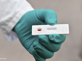 België zal coronatest van ZenTech niet gebruiken
