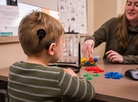 Cochleaire implantaten kinderen met ernstig gehoorverlies/doofheid terugbetaald