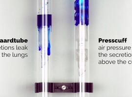 VUB- en UZ Brussel-spin-off 'Presscuff'-beademingsbuis haalt 781.000 euro op