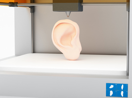 Italiaanse chirurgen gebruiken 3D-geprint model om oor te reconstrueren