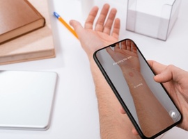 AI in de dermatologie verbetert de herkenning van huidaandoeningen, maar niet de te volgen aanpak