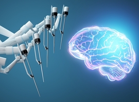 Des neurotechnologies dopées à l'IA menacent le secret mental, affirme l'Unesco