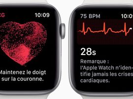 Apple Watch : l'ECG intégré est maintenant disponible en Belgique ... Attention aux faux positifs