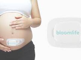 Bloomlife reçoit le feu vert de la FDA pour le MFM-Pro, un dispositif de surveillance maternelle et fœtale
