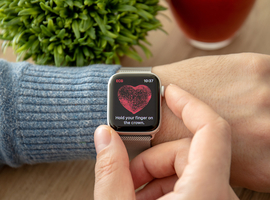 Apple Watch met ECG-functie nu ook beschikbaar in België, maar het is uitkijken voor valse-positieve resultaten