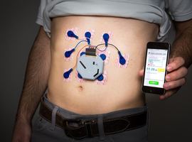 Elektrogastrografie nieuwe leven ingeblazen met connected tools 