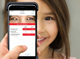 iPhone-app vervangt dure toestellen om oogproblemen op te sporen bij kinderen  