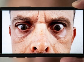 Un smartphone capable de mesurer le strabisme avec la précision d'un ophtalmo