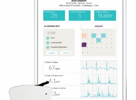 Kino : un monitoring cardiaque à distance d’un nouveau genre