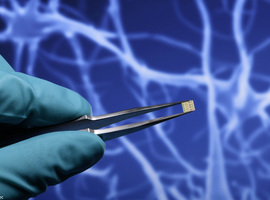 Neuromodulation : vers un implant pour traiter la dépression et la polyarthrite rhumatoïde ? 
