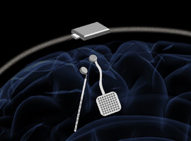 WAND : un nouveau dispositif de neurostimulation sans fil 