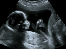 L’échographie et la mesure de la hauteur utérine sont-elles fiables pour déterminer la durée de la grossesse?