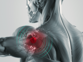 Cadaver course shoulder arthroplasty 2019: The difficult shoulder