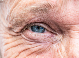La dégénérescence maculaire liée à l'âge peut désormais être traitée grâce à une lentille