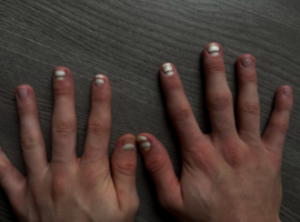 Votre plus belle image: Le mystère des ongles blancs