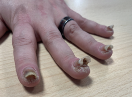 La plus belle image: des ongles plus (b)hauts