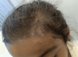 Het Mooiste beeld: Geen hongersnood in Gaza? De huid spreekt…