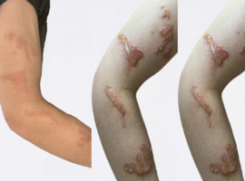 La plus belle image: Qui s’y frotte, s’y pique!