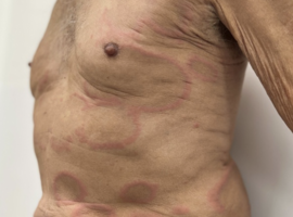 Het mooiste beeld: wanneer het klinische beeld de diagnose voorafgaat