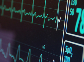 OLV Aalst zet schouders onder artificiële intelligentie om hartfilmpjes te analyseren