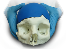 3D-Side : l’implant unique 